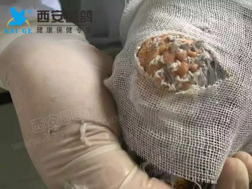 凱鴿,賽鴿醫(yī)院,鴿子腫瘤